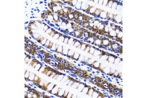 Immunohistochemistry of paraffin-embedded human colon using FASN antibody (ABIN1872662) at dilution of 1:100 (40x lens). (Fatty Acid Synthase 抗体)
