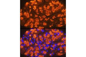 Immunofluorescence analysis of rat pancreas cells using CTRL Rabbit mAb (ABIN7266395) at dilution of 1:100 (40x lens).