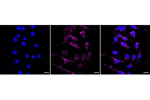 Immunocytochemical staining of HeLa cells with NDUFB4 antibody (ABIN7799551), 1:1,000).