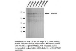 Image no. 1 for anti-MAD1 Mitotic Arrest Deficient-Like 1 (MAD1L1) antibody (ABIN341033) (MAD1L1 抗体)