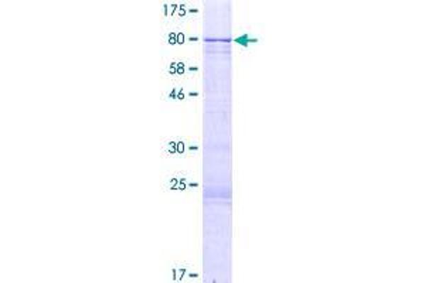 ZNF257 Protein (AA 1-531) (GST tag)