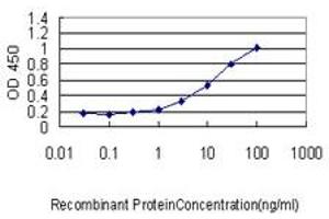 Detection limit for recombinant GST tagged VSNL1 is approximately 0.
