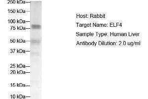 WB Suggested Anti-ELF4 Antibody Titration:  2 ug/ml  ELISA Titer:  1:312500  Positive Control:  Human Liver (Elf4 抗体  (N-Term))