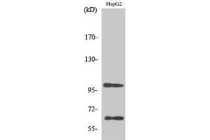 Western Blotting (WB) image for anti-Signal-Regulatory Protein alpha (SIRPA) (C-Term) antibody (ABIN3186961) (SIRPA 抗体  (C-Term))