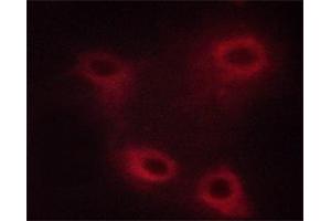ABIN6267507 staining HUVEC cells by ICC/IF. (MAP3K8 抗体  (pThr290))