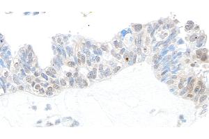 anti-Ubiquitin Specific Peptidase 10 (USP10) (AA 50-100) antibody