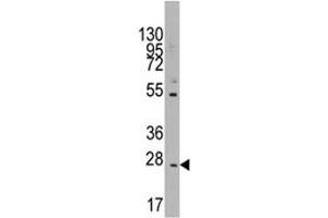 Western blot analysis of CD8B in K562 lysate (CD8B 抗体  (AA 64-92))