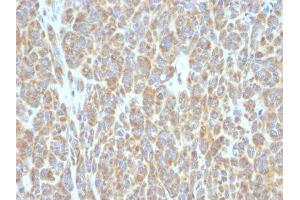 Image no. 1 for anti-B-Cell CLL/lymphoma 6 (BCL6) antibody (ABIN6175703) (BCL6 抗体)