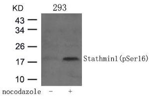 Western blot analysis of extracts from 293 cells untreated or treated with Nocodazol using Stathmin 1(Phospho-Ser16) Antibody. (Stathmin 1 抗体  (pSer16))