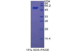 SDS-PAGE analysis of Rat ENPP1 Protein. (ENPP1 蛋白)