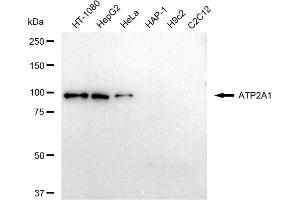 Western blotting analysis using ATP2A1 antibody (ABIN7797693).