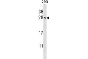 Western Blotting (WB) image for anti-Homeobox B4 (HOXB4) antibody (ABIN2998005) (HOXB4 抗体)