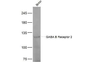 Mouse brain lysates probed with GABA B Receptor 2 Polyclonal Antibody, Unconjugated  at 1:500 dilution and 4˚C overnight incubation. (GABBR2 抗体  (AA 501-650))
