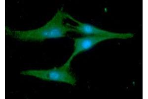 ICC/IF analysis of Synaptobrevin2 in U87MG cells line, stained with DAPI (Blue) for nucleus staining and monoclonal anti-human Synaptobrevin2 antibody (1:100) with goat anti-mouse IgG-Alexa fluor 488 conjugate (Green). (VAMP2 抗体)