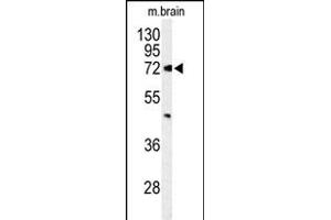 Western blot analysis of ABCD2 Antibody (Center) (ABIN653579 and ABIN2842954) in mouse brain tissue lysates (35 μg/lane). (CCL17 抗体  (AA 269-298))