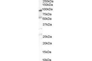 ABIN2564304 (1µg/ml) staining of human duodenum lysate (35µg protein in RIPA buffer).