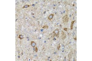 Immunohistochemistry of paraffin-embedded mouse spinal cord using HYOU1 antibody. (HYOU1 抗体)
