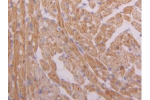 DAB staining on IHC-P; Samples: Mouse Heart Tissue