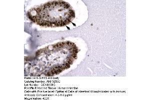 Human Intestine (SIRT5 抗体  (C-Term))