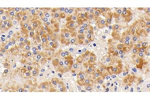 Detection of CYCS in Human Adrenal gland Tissue using Polyclonal Antibody to Cytochrome C (CYCS)