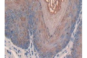 DAB staining on IHC-P; Samples: Mouse Esophagus Tissue (SLPI 抗体  (AA 20-131))