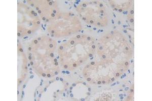Used in DAB staining on fromalin fixed paraffin- embedded kidney tissue (Fibrillarin 抗体  (AA 37-275))