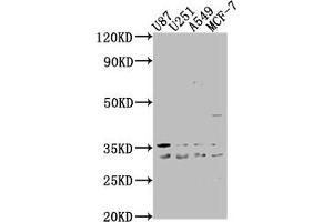 Western Blot Positive WB detected in: U87 whole cell lysate, U251 whole cell lysate, A549 whole cell lysate, MCF-7 whole cell lysate All lanes: ATP6V1D antibody at 1:2000 Secondary Goat polyclonal to rabbit IgG at 1/50000 dilution Predicted band size: 29 kDa Observed band size: 29 kDa (ATP6V1D 抗体  (AA 1-247))