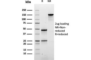 SDS-PAGE Analysis of Purified Desmoglein-3 Mouse Monoclonal Antibody (DSG3/2840). (Desmoglein 3 抗体  (AA 379-491))