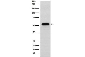 Western blot analysis of Syntrophin alpha 1 expression in A549 cell lysate.