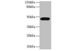 Western blot All lanes: LIPA antibody at 10 μg/mL + A431 whole cell lysate Secondary Goat polyclonal to rabbit IgG at 1/10000 dilution Predicted band size: 46, 40 kDa Observed band size: 46 kDa (Lipase A 抗体  (AA 22-399))