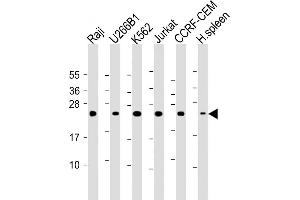 All lanes : Anti- CTLA4 Antibody (N-term) at 1:2000 dilution Lane 1: Raji whole cell lysate Lane 2: U266B1 whole cell lysate Lane 3: K562 whole cell lysate Lane 4: Jurkat whole cell lysate Lane 5: CCRF-CEM whole cell lysate Lane 6: Human spleen lysate Lysates/proteins at 20 μg per lane. (CTLA4 抗体  (AA 50-78))