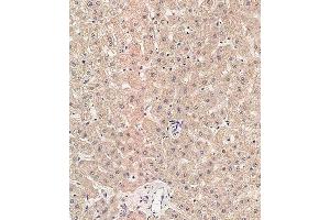 Immunohistochemical analysis of paraffin-embedded human liver tissue using (ABIN657731 and ABIN2846716) performed on the Leica® BOND RXm. (RAB1B 抗体  (C-Term))