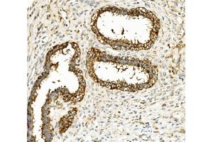 IHC analysis of Hexokinase 1/HK1 using anti-Hexokinase 1/HK1 antibody (ABIN7600258). (Hexokinase 1 抗体  (AA 17-323))