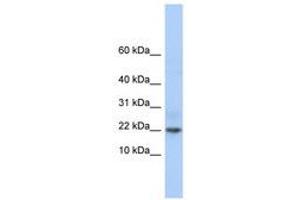 Image no. 1 for anti-Chromosome 9 Open Reading Frame 25 (C9orf25) (C-Term) antibody (ABIN6741337) (C9orf25 抗体  (C-Term))
