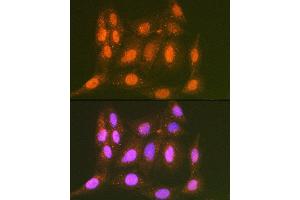 Immunofluorescence analysis of C6 cells using LTH Rabbit mAb (ABIN7268244) at dilution of 1:100 (40x lens). (LTA4H 抗体)
