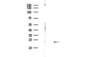 anti-Ubiquitin-Conjugating Enzyme E2K (UBE2K) (C-Term) antibody