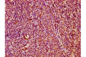 Immunohistochemistry (IHC) image for anti-Killer Cell Lectin-Like Receptor Subfamily C, Member 3 (KLRC3) (AA 94-240) antibody (ABIN7161649)