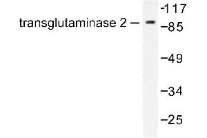 Image no. 1 for anti-Transglutaminase 2 (C Polypeptide, Protein-Glutamine-gamma-Glutamyltransferase) (TGM2) antibody (ABIN271855) (Transglutaminase 2 抗体)