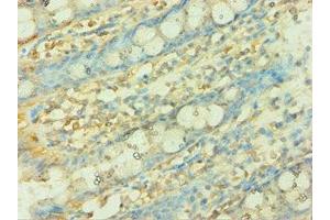 Immunohistochemistry of paraffin-embedded human colon tissue using ABIN7149303 at dilution of 1:100 (CISH 抗体  (AA 1-257))