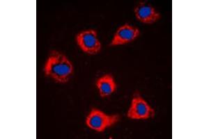Immunofluorescent analysis of Caspase 9 staining in NIH3T3 cells. (Caspase 9 抗体  (Center))