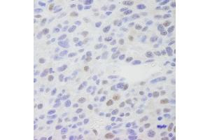 Immunohistochemistry (IHC) image for anti-Mediator Complex Subunit 1 (MED1) (C-Term) antibody (ABIN7448659) (MED1 抗体  (C-Term))