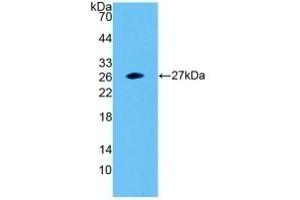 Detection of Recombinant SNAP23, Human using Polyclonal Antibody to Synaptosomal Associated Protein 23 kDa (SNAP23) (SNAP23 抗体  (AA 1-211))