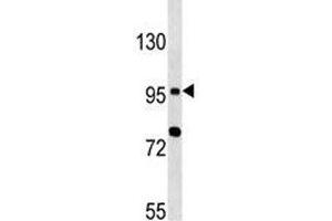 TLR6 antibody western blot analysis in MCF-7 lysate (TLR6 抗体  (AA 1-30))