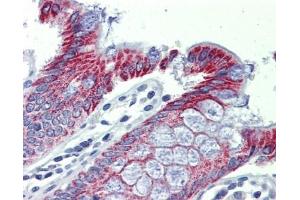 ACAA1 antibody was used for immunohistochemistry at a concentration of 4-8 ug/ml. (ACAA1 抗体)