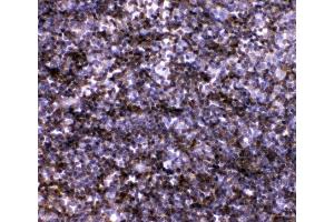 IHC analysis of IL7 using anti-IL7 antibody (ABIN3044526).