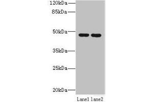 Western blot All lanes: ZDHHC6 antibody at 0. (ZDHHC6 抗体  (AA 227-409))