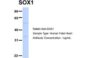 Host: Rabbit Target Name: SOX1 Sample Type: Human Fetal Heart Antibody Dilution: 1. (SOX1 抗体  (Middle Region))