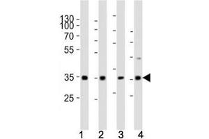 Western blot analysis of lysate from (1) human HeLa cell line, (2) mouse spleen, (3) rat lung, (4) rat stomach tissue using Cyclin D3 antibody at 1:1000. (Cyclin D3 抗体  (AA 33-66))