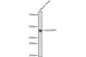 Western blot analysis of extracts of Mouse kidney, using SQS/FDFT1 Rabbit mAb (ABIN7267130) at 1:1000 dilution. (FDFT1 抗体)