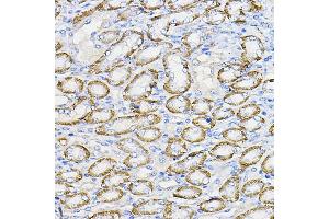 Immunohistochemistry of paraffin-embedded mouse kidney using NUBP1 Rabbit pAb (ABIN7269062) at dilution of 1:100 (40x lens). (NUBP1 抗体  (AA 201-320))